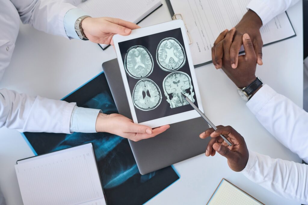 Doctors examining brain MRI scans on a tablet, discussing medical findings with one physician pointing at the images