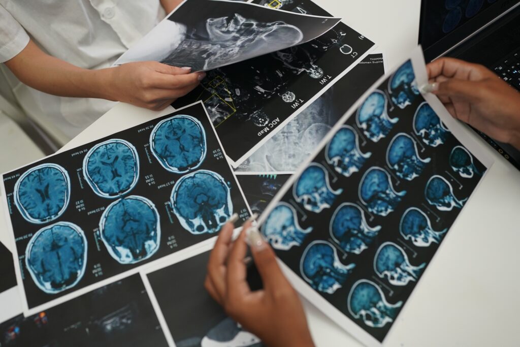 Group of doctors looking at X-ray on medical conference, discussing issues