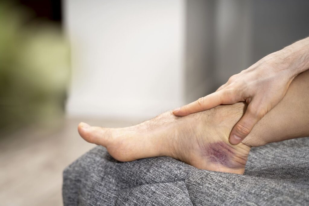 Ankle Injury After Workplace Accident