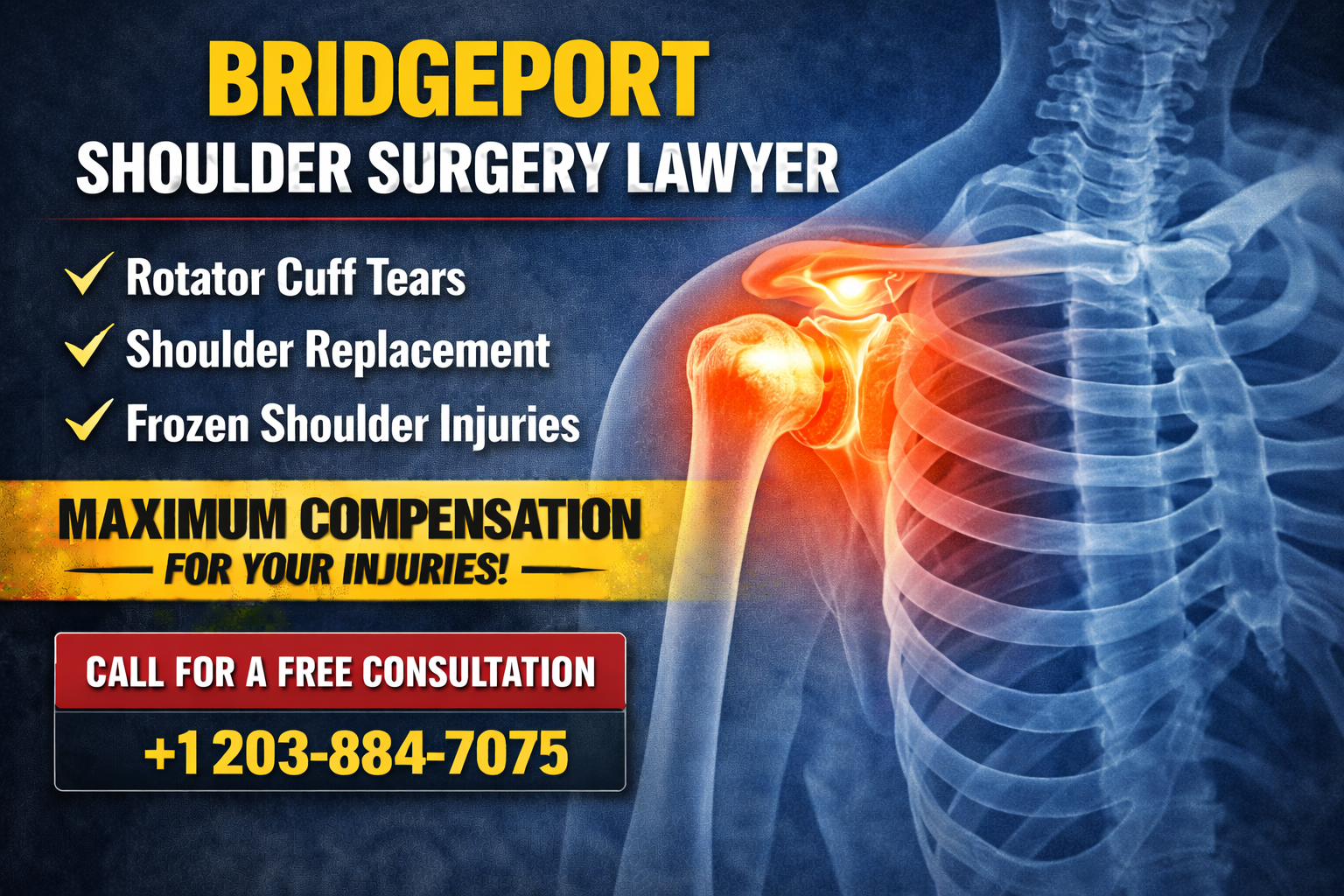 lawyer shoulder injury